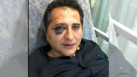 Cumhurbaşkanı Erdoğan'ın korumaları Ağır Ceza'ya sevk edildi