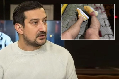 Serhat Akın'a silahla saldıran 2 kişi yakalandı