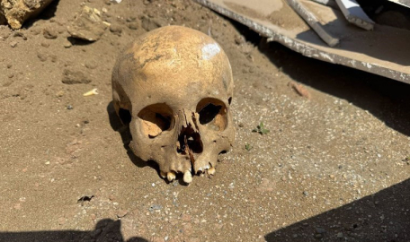 Boş arazide kazı yapılırken kafatası ortaya çıktı