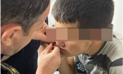 Bursa'da oyun oynayan çocuğun ağzına balık oltası takıldı