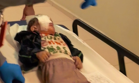 Bursa'da torpil faciasında 2 yaşındaki çocuk ağır yaralandı