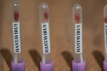 Sağlık Bakanlığından 'hantavirüs' açıklaması: Türkiye'de vaka görüldü mü?