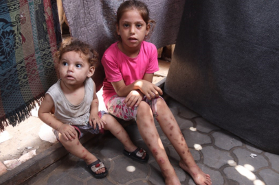 Gazze'de su çiçeği alarmı: İki haftada 9 bin 300 vaka